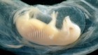 Tiny human hearts grown in pig embryos for the first time