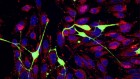 Cancer cells get power boost by stealing mitochondria from nerves