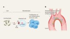 Gut bacteria make a molecule that promotes plaque build-up in arteries