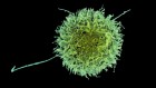 Turbocharged ‘killer’ cells show promise for autoimmune disease