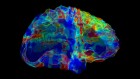 One potent gene raises risk of Alzheimer’s, Parkinson’s and other brain diseases