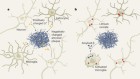 Does lithium deficiency contribute to Alzheimer’s disease?