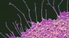 People’s brains aged faster during the COVID pandemic — even the uninfected
