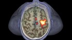 The brain fires up immune cells when sick people are nearby