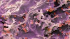 mRNA vaccines for HIV trigger strong immune response in people
