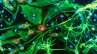 Brain editing now ‘closer to reality’: the gene-altering tools tackling deadly disorders