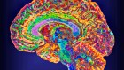A mind–reading brain implant that comes with password protection