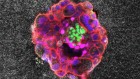 Watch a human embryo implant itself — with brute force